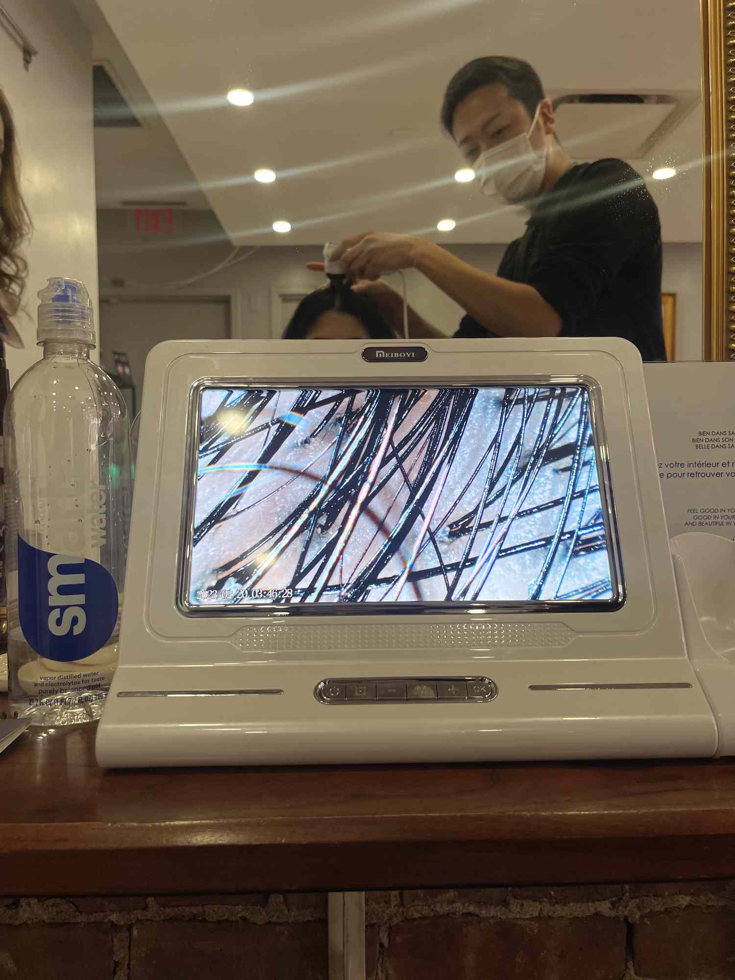 The author's scalp and hair roots on a computer screen