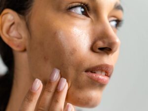 If You Have Oily Skin, Should You Moisturize at Night?