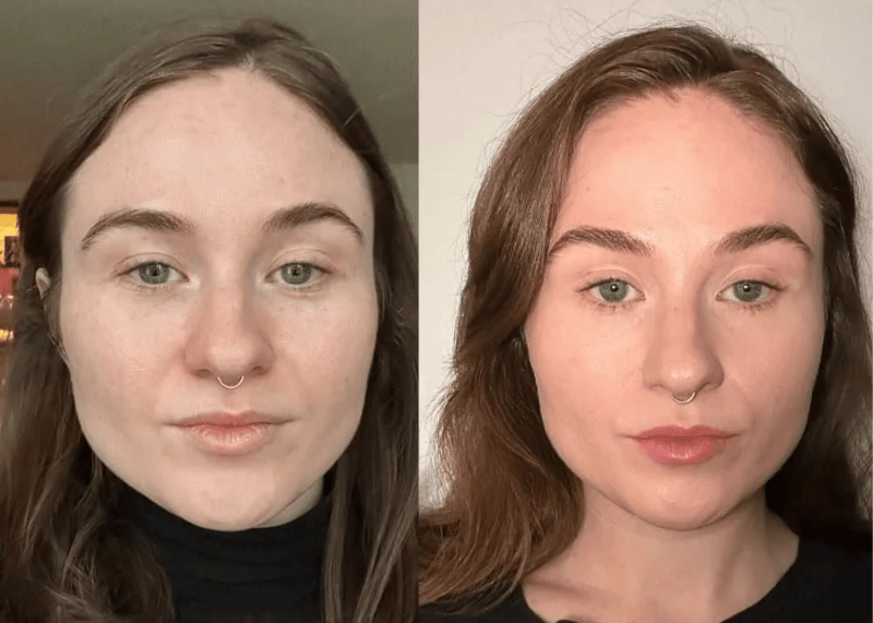 "Buccal Massage" Can Help Contour Your Jawline: Benefits and What to Expect